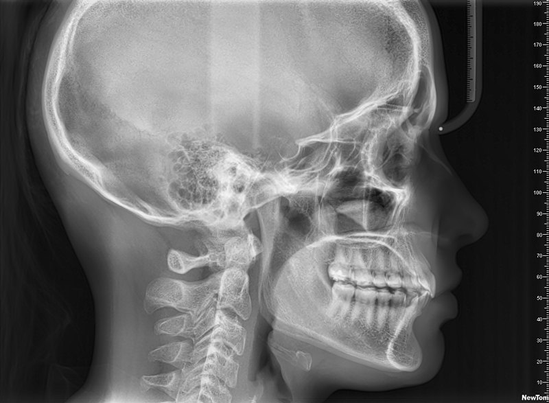 imagen-lateral-de-craneo-rd