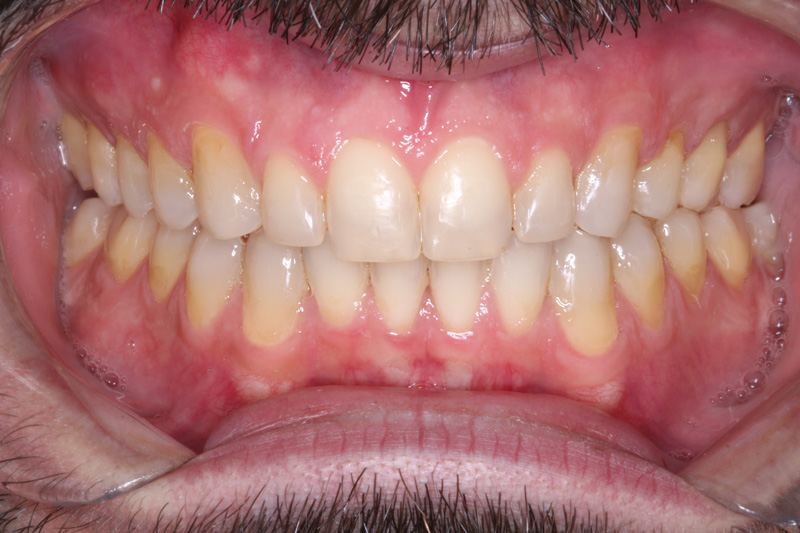vista-intraoral
